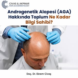 Toplum, androgenetik alopesi (erkek tipi saç dökülmesi) hakkında ne kadar bilgi sahibi?🧐
553 kişiyl