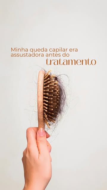 Joseana sempre teve uma certa queda de cabelo, mas, nos últimos meses, percebeu uma intensificação i