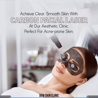 1. "Glow up! Reveal radiant, smoother skin with our Carbon Laser Facial treatment #CarbonLaserFacial