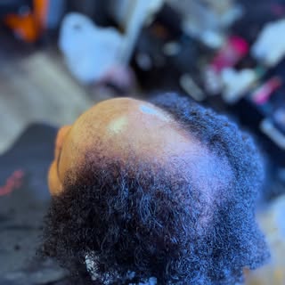 “If she can’t grow it you’ll NEVA know it”
#hairtransformation #blackhairstyles #alopecianbeauty #al