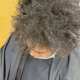 Beautiful transformation!!! #hairreels #hairlinerestoration #kchairstylist #hairtransformations #hai