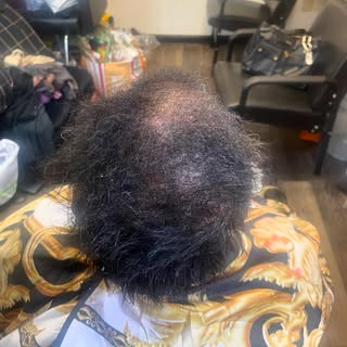 If she can grow it you’ll NEVA know it! #alopecia #alopecianbeauty #kchairstylist #hairrestoration #
