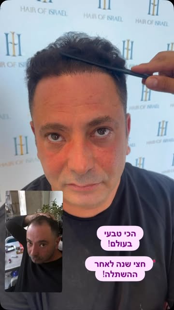 תכירו את ליאור היקר ❤️
מטופל שנכנס לנו עמוק ללב, אדם עם הכרת הטוב ענקית והמון מילים טובות שריגשו אות