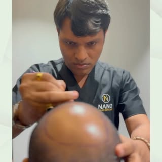 “New hair, new me! 💇‍♂️ #NHI #HairTransplantJourney”# 
To book a consultation with our expert, plea