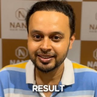 Unbelievable right ! Witness NHI’s magical life changing transformations ✨

☎️ 9690333111