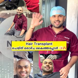 ഒരാഴ്ച കഴിഞ്ഞപ്പോൾ എന്റെ തലമുടിയുടെ മാറ്റം കണ്ട് ഞാൻ ഞെട്ടിപ്പോയി 👍💕1 Week Updation This
ഞാൻ എല്ലാ