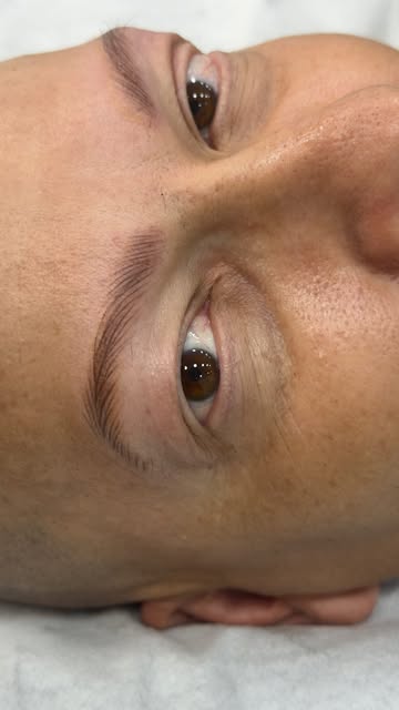 Cejas masculinas, en alopecia universal.
Mira si antes y después