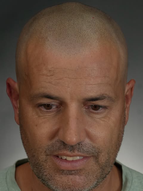 FOTOS EN CRUDO 👐🏼

En este caso, la mayor preocupación del cliente era que el resultado se viera n