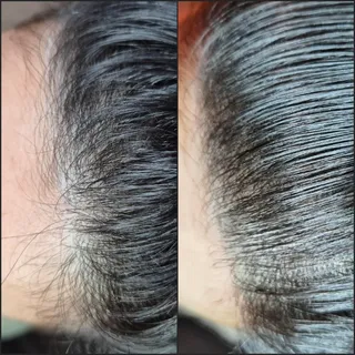✨️Wat een mooie, volle haarlijn!✨️
Het lijkt er weer veel dikker uit te zien.

🪄Optisch bedrog, maa