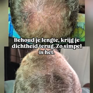 ​Behoud je lengte, krijg je dichtheid terug. Zo simpel is het. ✨💪
​Of je nu een man bent die zijn k