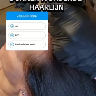 ✨️Beantwoord de vraag in de reel, zou jij dit doen?

Zo nee,  ik ben benieuwd waarom niet. 

Laat he
