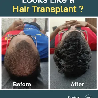 Before you choose a transplant… read this.”
90% people rush into surgery when they don’t need it.
GF
