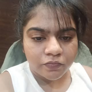 केस गळती कधी गंभीर मानायची? 🤔
आपल्याला रोज 50–100 केस गळणे नॉर्मल असतं. पण जर केस गळती 1 महिन्यापेक