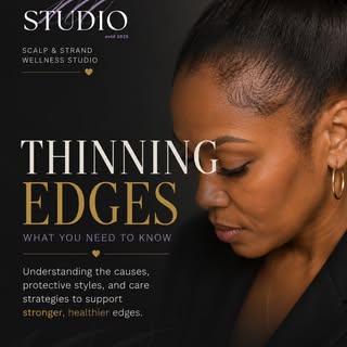 Your edges are trying to tell you something. 

Thinning edges don't always mean permanent hair loss.