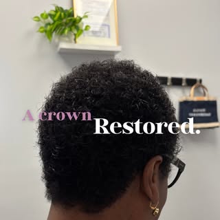 A crown restored. 

She came with concerns about excessive shedding, searching for answers. 

With t