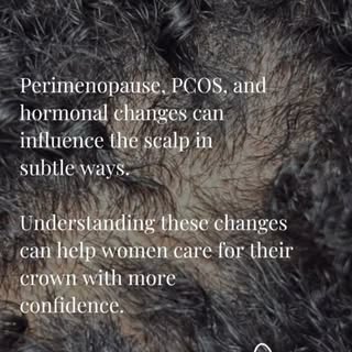 Hormonal changes don’t just affect how you feel ~ they can also influence your scalp and hair.

Unde