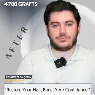 "Thinking of a new look? 🌱 Let's bring back that hair and your self-confidence! ✨ CONTACT US to tur