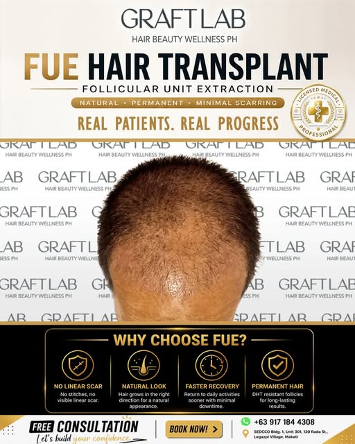 Swipe to see this incredible real patient progress! ✨
Our advanced, minimally invasive procedure del