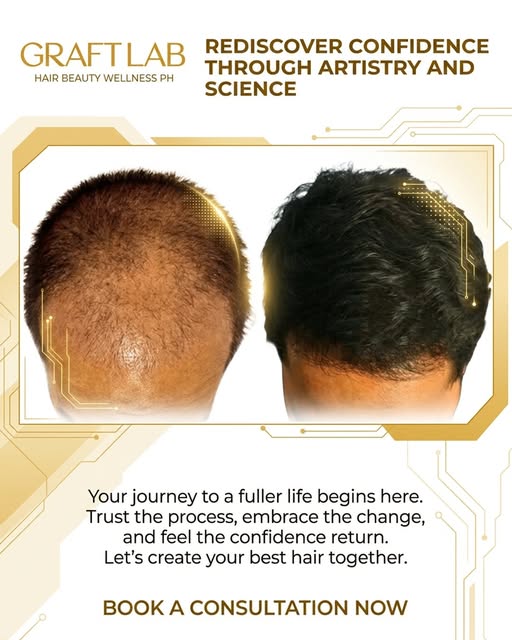 Rediscover your confidence through the perfect blend of artistry and science with GraftLab Philippin