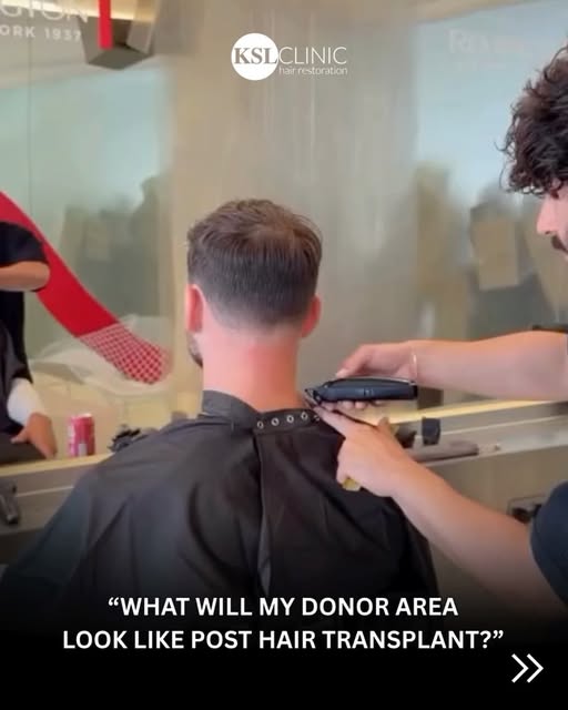 How will my donor area look after my hair transplant?” 👀

Once fully healed, not any different…..


