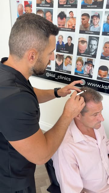 @nickpickardofficial shares how hair loss has affected him and why he came to us, at KSL Clinic to e