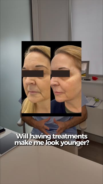 “Will treatment make me look younger?” is a question I hear quite often.

I tend to look at it sligh