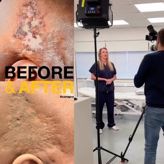 Little sneak peak of yesterdays filming . 
Showing before , during filming and after.  This was a re