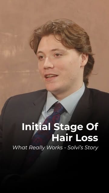 When Solvi first started noticing hair loss around 2021, Minoxidil was enough to help stabilise his 
