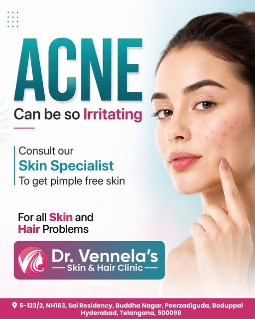 𝗔𝗖𝗡𝗘 𝗖𝗔𝗡 𝗕𝗘 𝗦𝗢 𝗜𝗥𝗥𝗜𝗧𝗔𝗧𝗜𝗡𝗚:

Persistent acne, breakouts, or blemishes affecting 