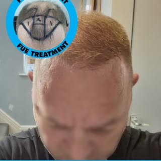 8 month post op result
Book your free consultation to get started at www.mycosmeticcentre.com