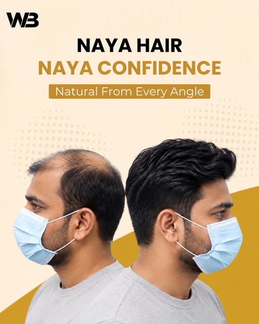 Natural-looking wigs designed to give you effortless volume, coverage, and a beautiful transformatio