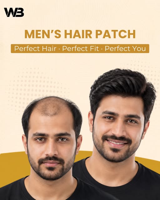 Hair patch can make—restoring natural-looking volume, confidence, and a refreshed appearance. 

📍 W