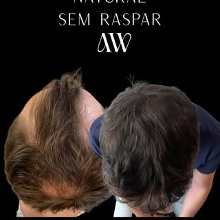 Um novo cabelo pode mudar muito mais do que a aparência… pode transformar a forma como você se vê no