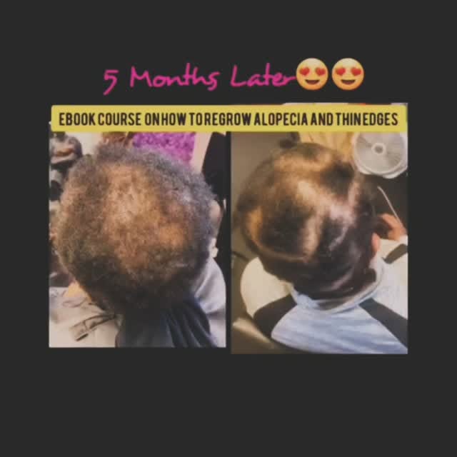 Book your hair loss consultation today with the DMV WeaveDr Hair Growth products now available #hair