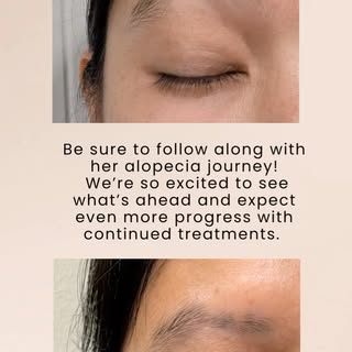 Regrowth is possible!
Early diagnosis and the right treatment can help give those hairs  a chance to