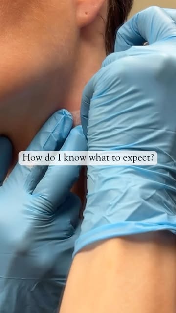 Have you met my dermatologist?... Oh wait..😏
Who better to trust with your skin than a dermatologis