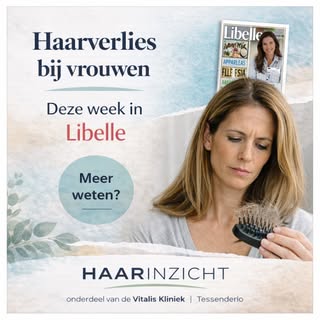 Deze week verscheen een interessant artikel in @libellebelgie over haarverlies bij vrouwen.
Veel vro