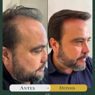 O resultado final ainda nem chegou, mas a diferença de quem se olha no espelho já é inegável. 

Acom