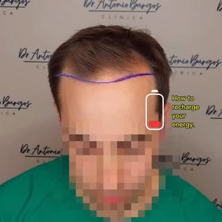 🔋🔋¡RECARGA PILAS RECUPERANDO TU IMAGEN! 😃🔋🔋

💇‍♂️✨ A veces, un pequeño cambio puede darte ese 