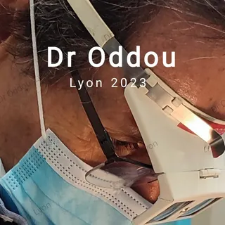 #Chirurgie des paupières: Soins post opératoires!