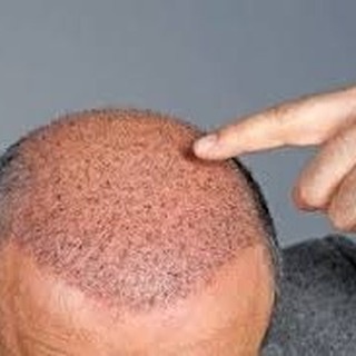 cabello en crecimiento