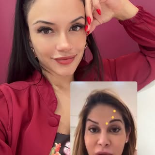 A influenciadora Maíra Cardi desabafou nas redes após uma aplicação de botox que não saiu como desej