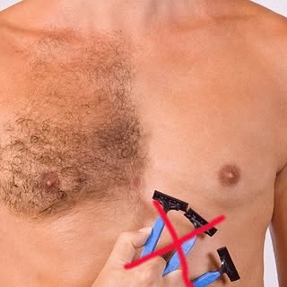 ⚡️⚡️LASER HAIR REMOVAL⚡️⚡️

Gents - Back & Chest 

£150 per session 

Start now…..you could be hair 