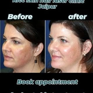 RLCC SKIN,HAIR & LASER CLINIC