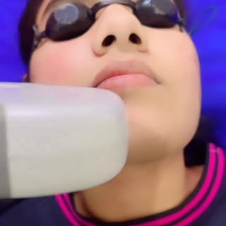 Face laser treatments offer numerous benefits, including reducing the appearance of wrinkles, fine l