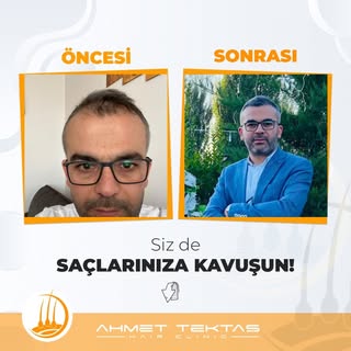 Hastamızın Muhteşem Değişimi!
~
Detaylı bilgi ve Randevu almak için;
📲 0 552 357 42 47
✉ info@ahmet