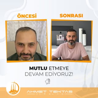 #SafirFueSaçEkimi ile başarılı operasyonlar 💪
~
Detaylı bilgi ve Randevu almak için;
📲 0 552 357 4