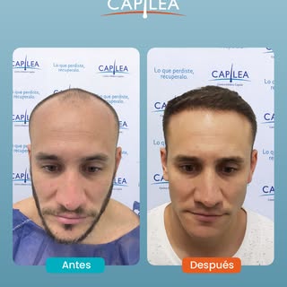 El espejo empezó a devolverle otra imagen.

Tiempo después de su implante, la diferencia ya se sient
