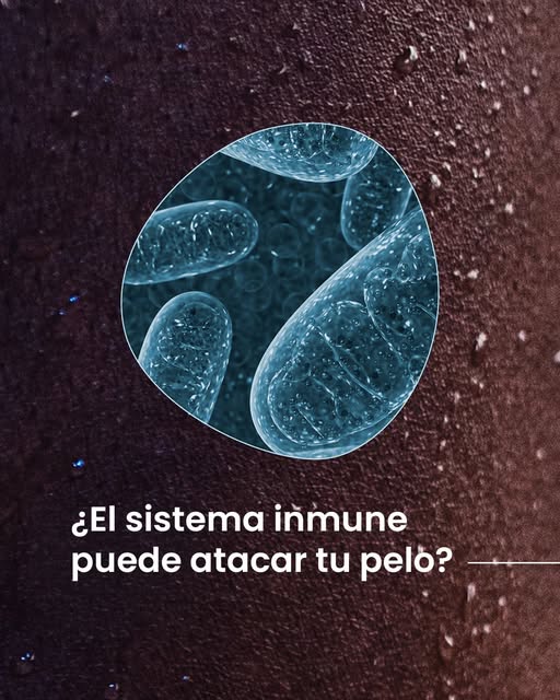 La alopecia areata puede aparecer sin avisar, afectando a jóvenes y adultos por igual. 

Identificar