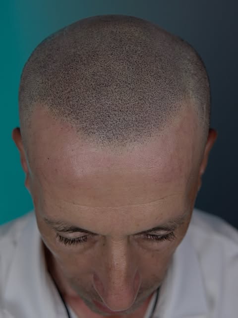 Yamani nos visita desde Logroño, cansado de depender siempre de la gorra y buscando volver a sentirs